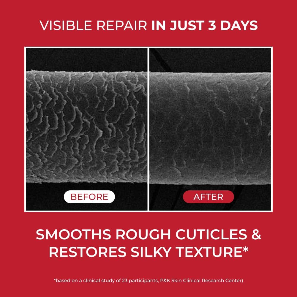 MOEV ANNURCATIN™ TREATMENT